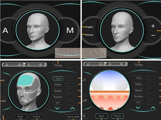 ত্বকের সংস্পর্শ সেন্সর সহ সেমিকন্ডাক্টর 808nm লেজার ডায়োড লেজার হেয়ার রিমুভাল মেশিন যা দ্রুত হেয়ার রিমুভাল চিকিৎসা নিশ্চিত করে