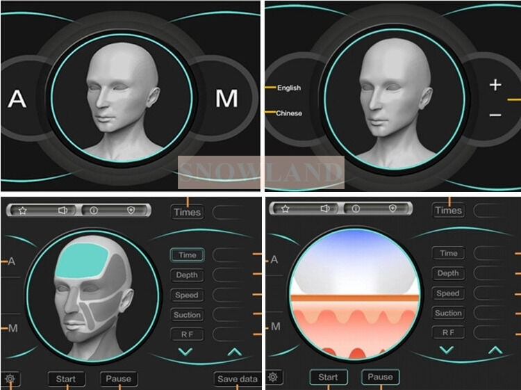 ত্বকের সংস্পর্শ সেন্সর সহ সেমিকন্ডাক্টর 808nm লেজার ডায়োড লেজার হেয়ার রিমুভাল মেশিন যা দ্রুত হেয়ার রিমুভাল চিকিৎসা নিশ্চিত করে